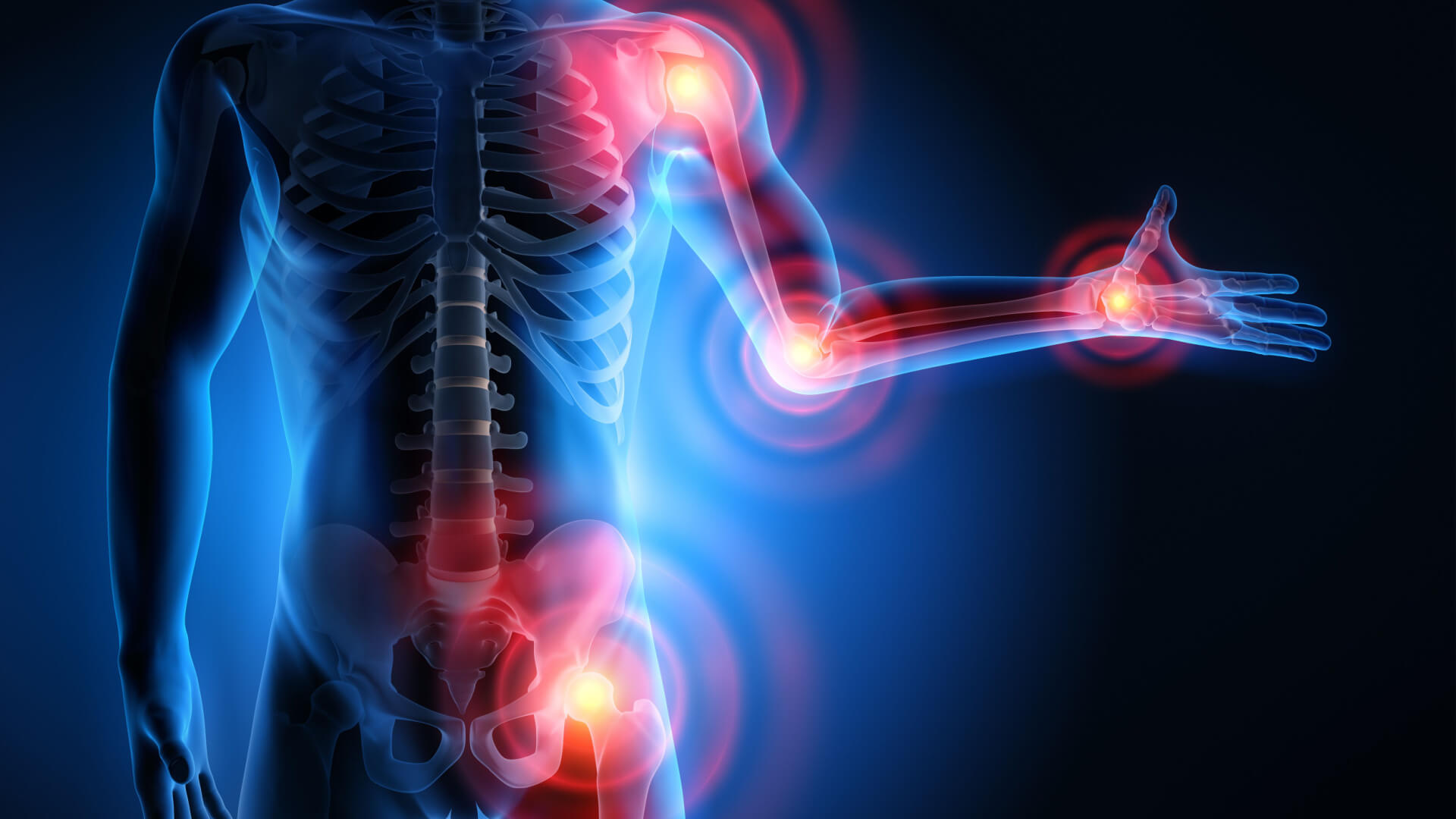 Chronic Inflammation
